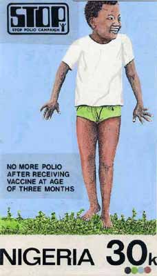 Nigeria 1984 Stop Polio Campaign - original hand-painted artwork for 30k value (Healthy Child) by NSP&MCo Staff Artist Olukoya Ogunfowora on card 5
